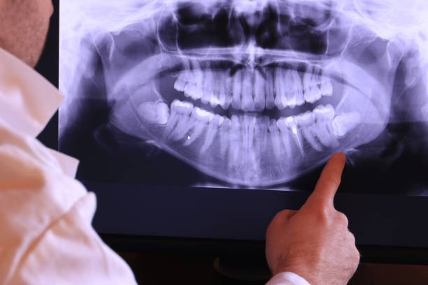 Best Emergency Treatment for Toothache in Ramblewood, NJ