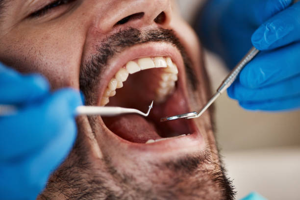 Best Emergency Broken Tooth Repair in Ramblewood, NJ